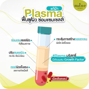 Plasma แก้ฝ้า คืออะไร ดียังไง ?