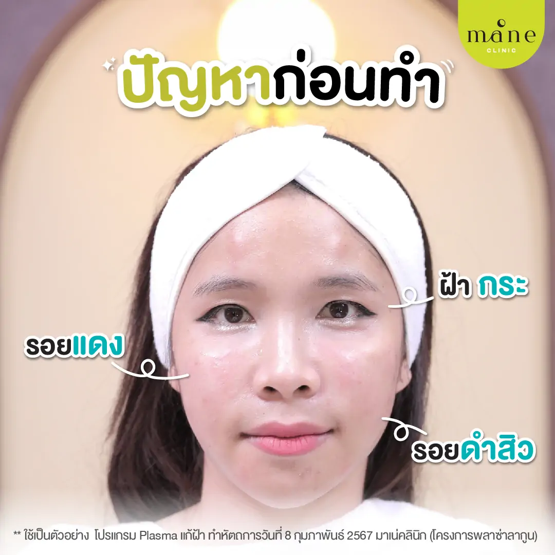 ปัญหาก่อนทำ