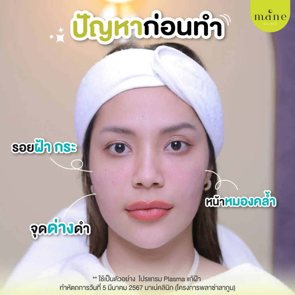 ปัญหาก่อนทำ