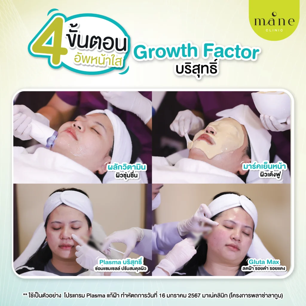 รีวิว plasma แก้ฝ้า ที่ mane clinic