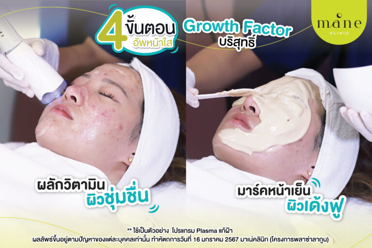 รีวิว plasma แก้ฝ้า ที่ mane clinic