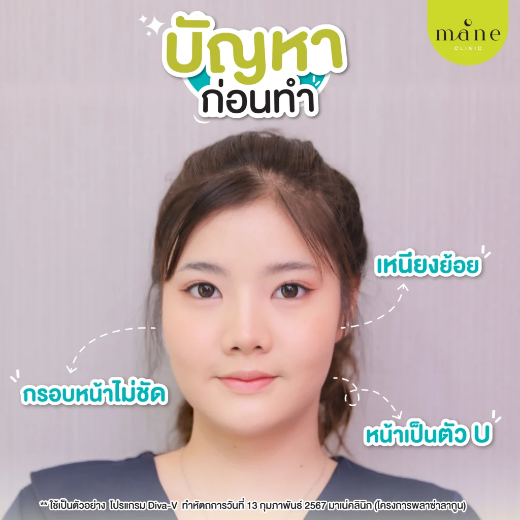 ปัญหาก่อนทำ