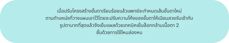 เมื่อปรับโครงสร้างชั้นตา